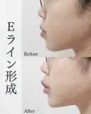 Eライン形成 after画像 サムネイル用