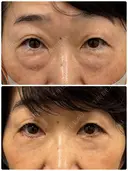 表ハムラ👀 before画像 サムネイル用