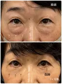 表ハムラ👀 after画像 サムネイル用