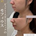 モフィウス8 30日後 サムネイル用