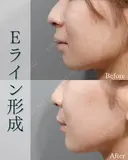 Eライン形成 after画像 サムネイル用