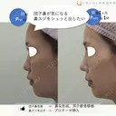 鼻フルナチュラル 30日後 サムネイル用