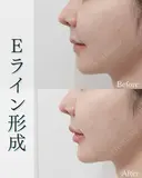 Eライン形成 after画像 サムネイル用