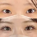 二重埋没法 after画像 サムネイル用