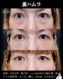 裏ハムラ before画像 サムネイル用