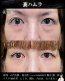 裏ハムラ after画像 サムネイル用