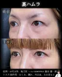 裏ハムラ after画像 サムネイル用