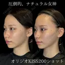 オリジオKISS 30日後 サムネイル用