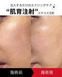 スネコスパフォルマ after画像 サムネイル用
