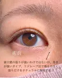 目頭切開 before画像 サムネイル用