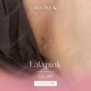 【韓国発】ダウンタイムなしで唇の色素沈着をケアできるLalapink♡ before画像 サムネイル用