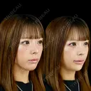 スマイルリップ（ボルベラ）アゴ（ボラックス） 0日後 サムネイル用