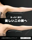 【二の腕】の脂肪吸引🧡 after画像 サムネイル用