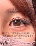 目頭切開 30日後 サムネイル用