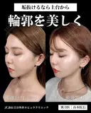 山本医師による🎀小顔脂肪吸引🎀 after画像 サムネイル用