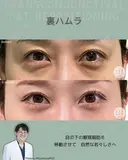 裏ハムラ before画像 サムネイル用