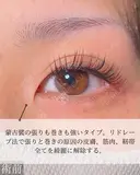 目頭切開 before画像 サムネイル用