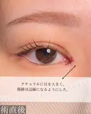 目頭切開 after画像 サムネイル用