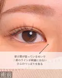 目頭切開 before画像 サムネイル用