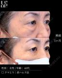 表ハムラ before画像 サムネイル用
