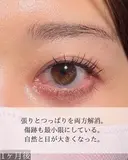 目頭切開 after画像 サムネイル用