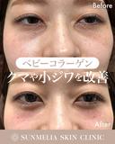 ベビーコラーゲン after画像 サムネイル用