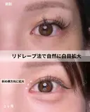 韓流目頭切開 30日後 サムネイル用