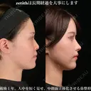 ゼティスは長期経過を大事にします。 365日後 サムネイル用