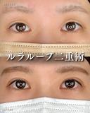 1dayルラループ after画像 サムネイル用