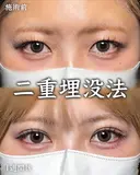 RÉシークレットダブル 7日後 サムネイル用