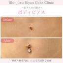 ピアスの穴開け 0日後 サムネイル用