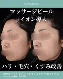 マッサージピール＋イオン導入(トラネキサム酸＋ビタミンC） before画像 サムネイル用