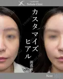 Dr浦野執刀🪄カスタマイズヒアル before画像 サムネイル用