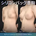 シリコンバッグ豊胸モティバ（モティバエルゴノミックス2 DEMI 360cc×左右） before画像 サムネイル用