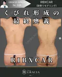 肋骨リモデリング after画像 サムネイル用