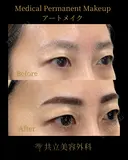 眉アートメイク after画像 サムネイル用