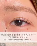 目頭切開 before画像 サムネイル用