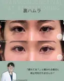 裏ハムラ before画像 サムネイル用