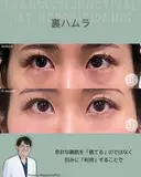 裏ハムラ after画像 サムネイル用