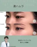 裏ハムラ after画像 サムネイル用