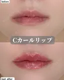 Cカールリップ before画像 サムネイル用