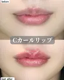 Cカールリップ before画像 サムネイル用