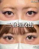 RÉシークレットダブル 30日後 サムネイル用