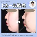 Cカール形成(猫手術) 90日後 サムネイル用