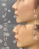 ✨なおき先生のcカール形成✨ 簡単垢抜けで大人気😍 before画像 サムネイル用