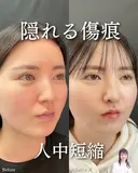 人中短縮 after画像 サムネイル用