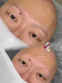 眉アートメイク before画像 サムネイル用