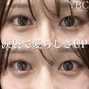 【涙袋ヒアルロン酸で可愛らしさアップ💗】 before画像 サムネイル用