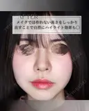 鼻プロテーゼ after画像 サムネイル用