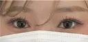 QCT（クイックコスメティークトリプルNeo） after画像 サムネイル用